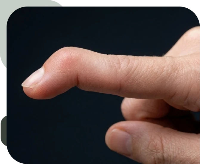 Quando a Cirurgia é Necessária